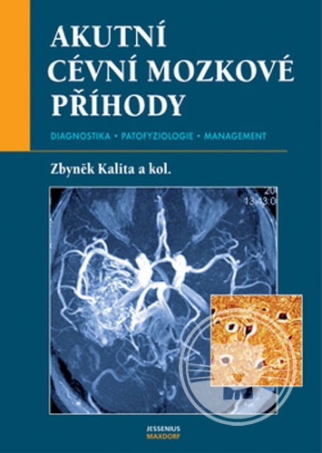 Akutní cévní mozkové příhody - diabnostika-patofyziologie-management